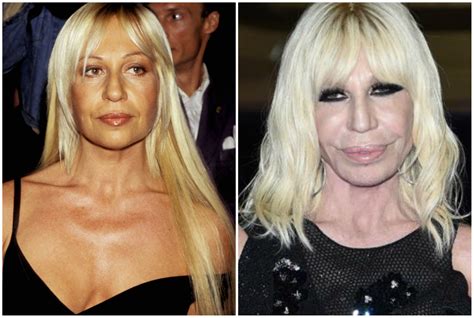 versace prima della chirurgia|donatella Versace vita.